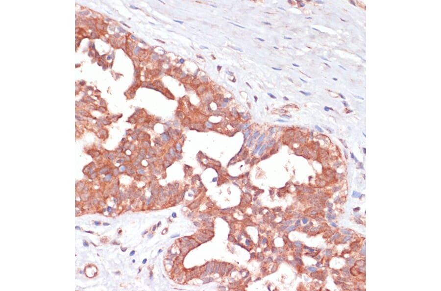 Immunohistochemistry - Anti-PGD Antibody (A15849) - Antibodies.com