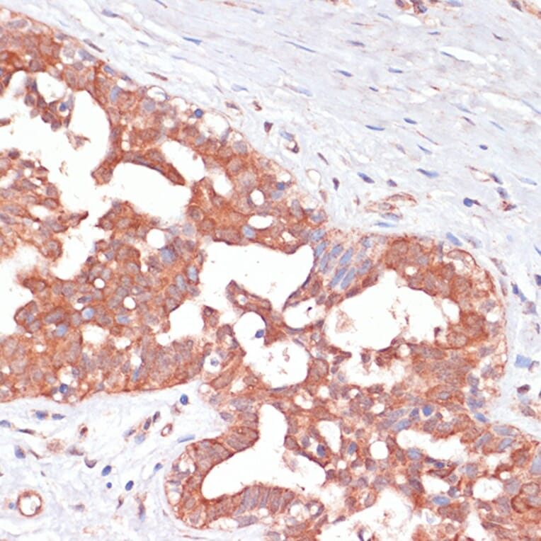 Immunohistochemistry - Anti-PGD Antibody (A15849) - Antibodies.com