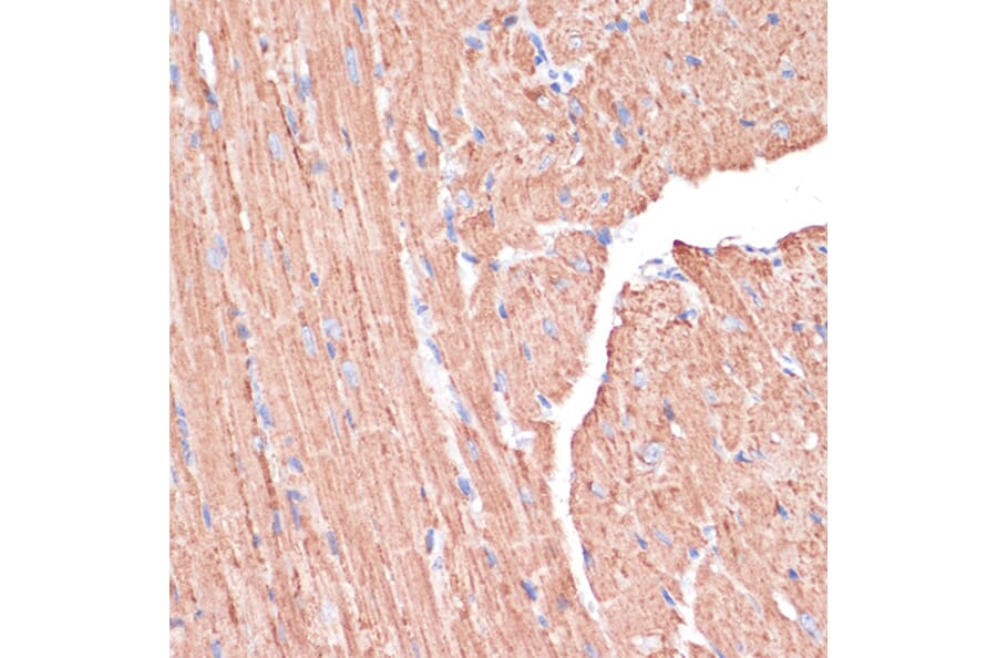 Immunohistochemistry - Anti-PGD Antibody (A15849) - Antibodies.com