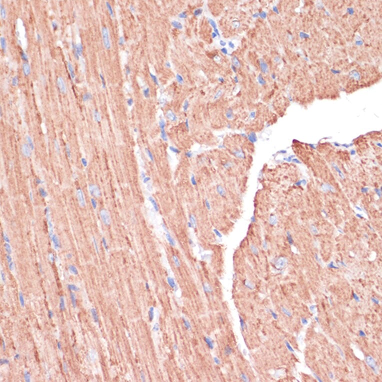 Immunohistochemistry - Anti-PGD Antibody (A15849) - Antibodies.com