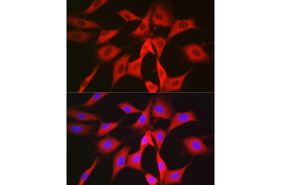 Immunofluorescence - Anti-PGD Antibody (A15849) - Antibodies.com