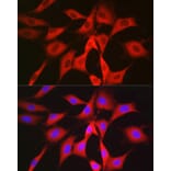 Immunofluorescence - Anti-PGD Antibody (A15849) - Antibodies.com