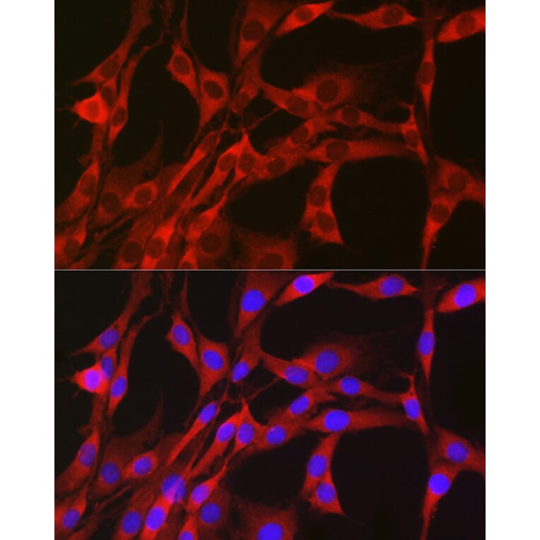 Immunofluorescence - Anti-PGD Antibody (A15849) - Antibodies.com