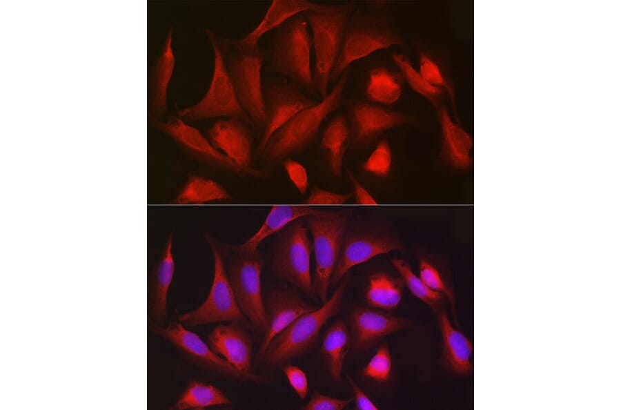 Immunofluorescence - Anti-PGD Antibody (A15849) - Antibodies.com