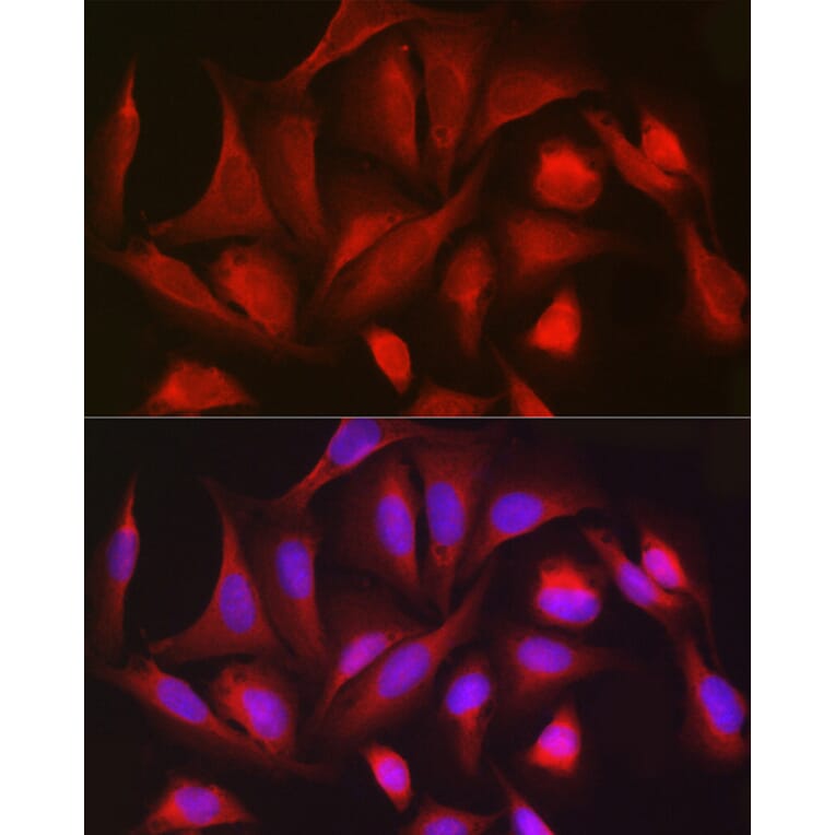 Immunofluorescence - Anti-PGD Antibody (A15849) - Antibodies.com