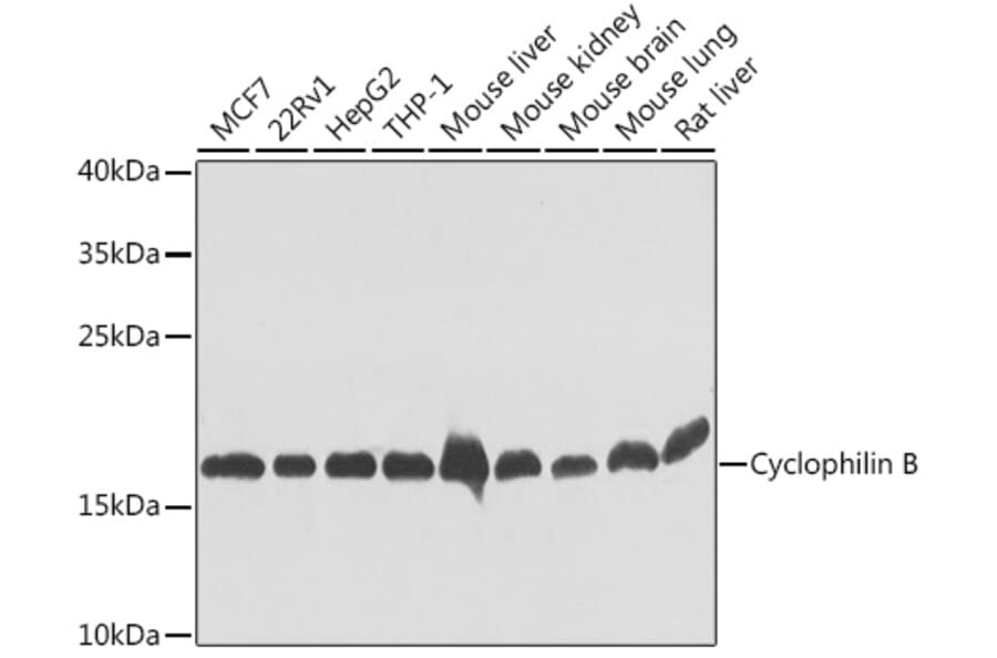 Western Blot - Anti-Cyclophilin B Antibody (A15850) - Antibodies.com