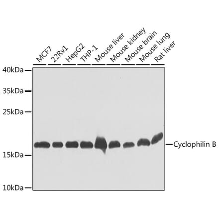 Western Blot - Anti-Cyclophilin B Antibody (A15850) - Antibodies.com