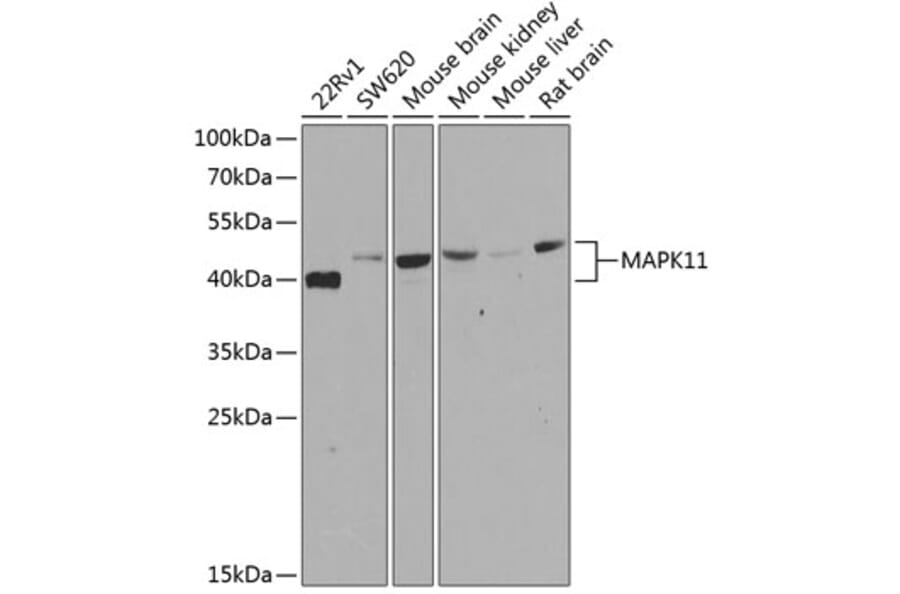 Western Blot - Anti-p38 beta/MAPK11 Antibody (A15851) - Antibodies.com