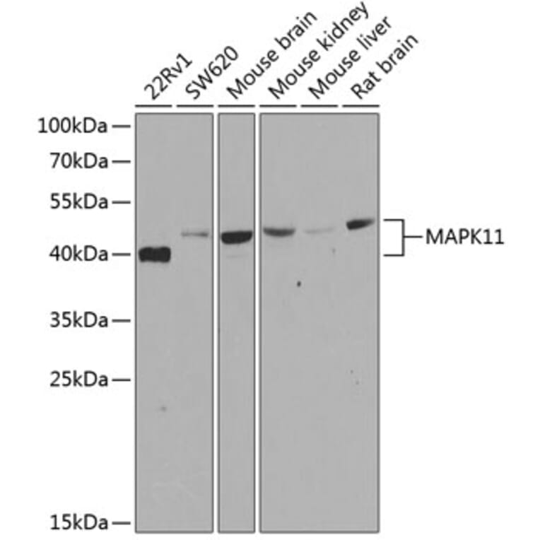 Western Blot - Anti-p38 beta/MAPK11 Antibody (A15851) - Antibodies.com