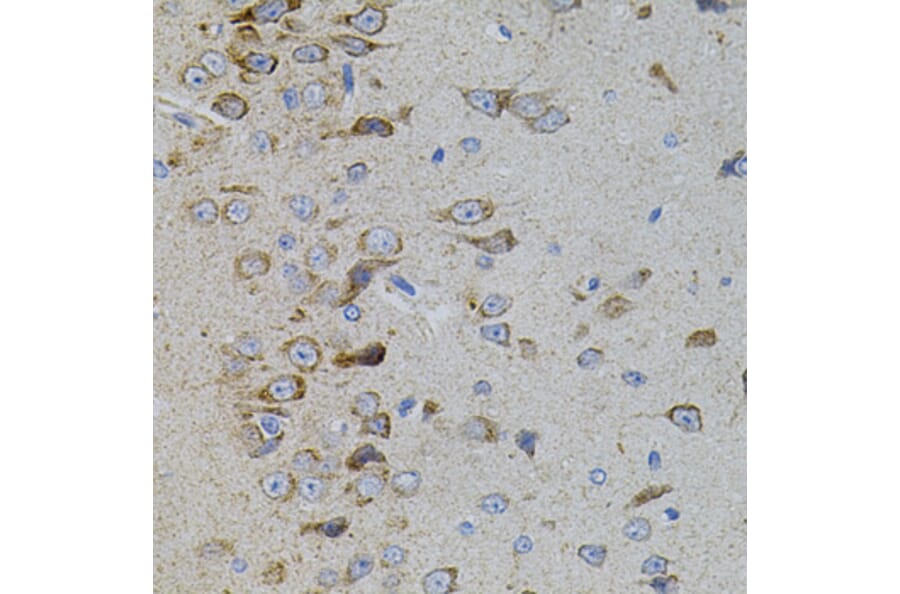 Immunohistochemistry - Anti-p38 beta/MAPK11 Antibody (A15851) - Antibodies.com