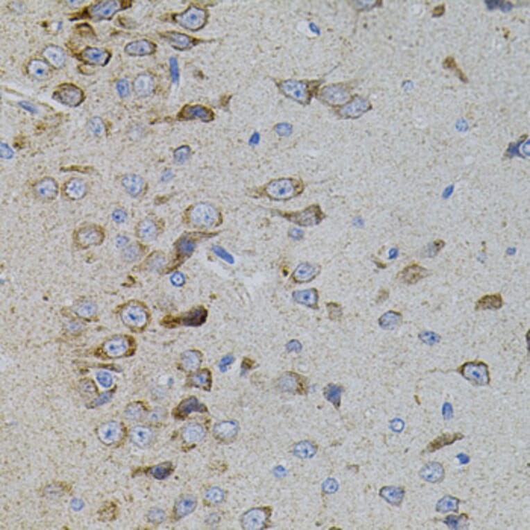 Immunohistochemistry - Anti-p38 beta/MAPK11 Antibody (A15851) - Antibodies.com
