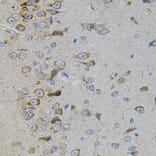 Immunohistochemistry - Anti-p38 beta/MAPK11 Antibody (A15851) - Antibodies.com