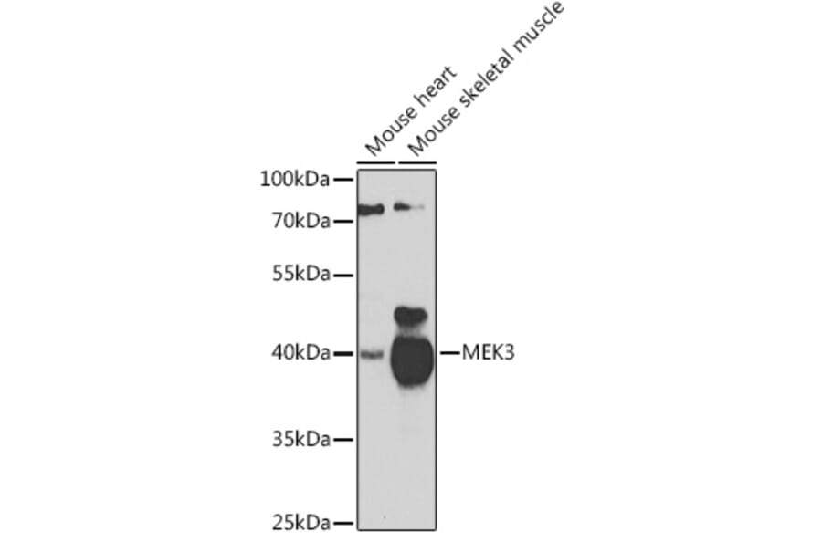 Western Blot - Anti-MEK3 Antibody (A15852) - Antibodies.com