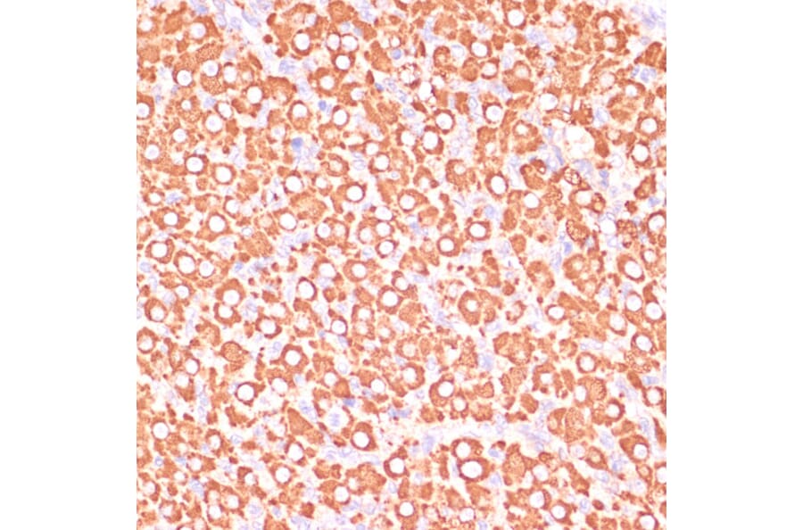Immunohistochemistry - Anti-MEK3 Antibody (A15852) - Antibodies.com
