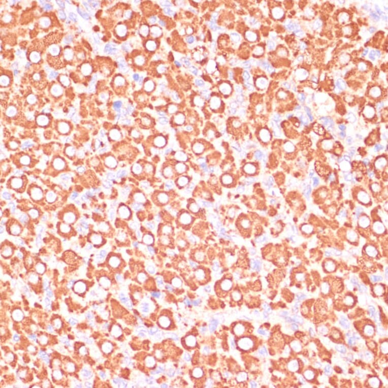Immunohistochemistry - Anti-MEK3 Antibody (A15852) - Antibodies.com