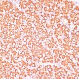 Immunohistochemistry - Anti-MEK3 Antibody (A15852) - Antibodies.com