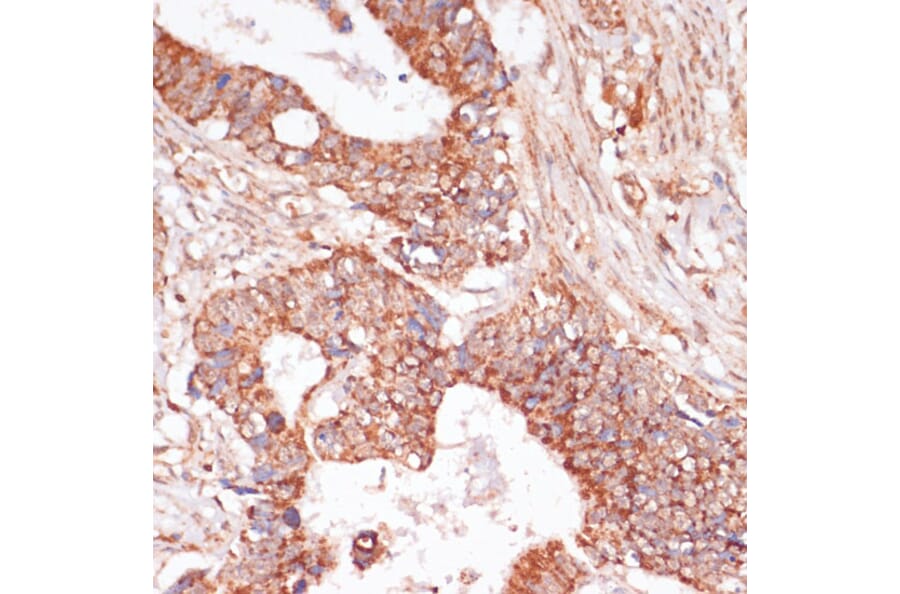 Immunohistochemistry - Anti-MEK3 Antibody (A15852) - Antibodies.com