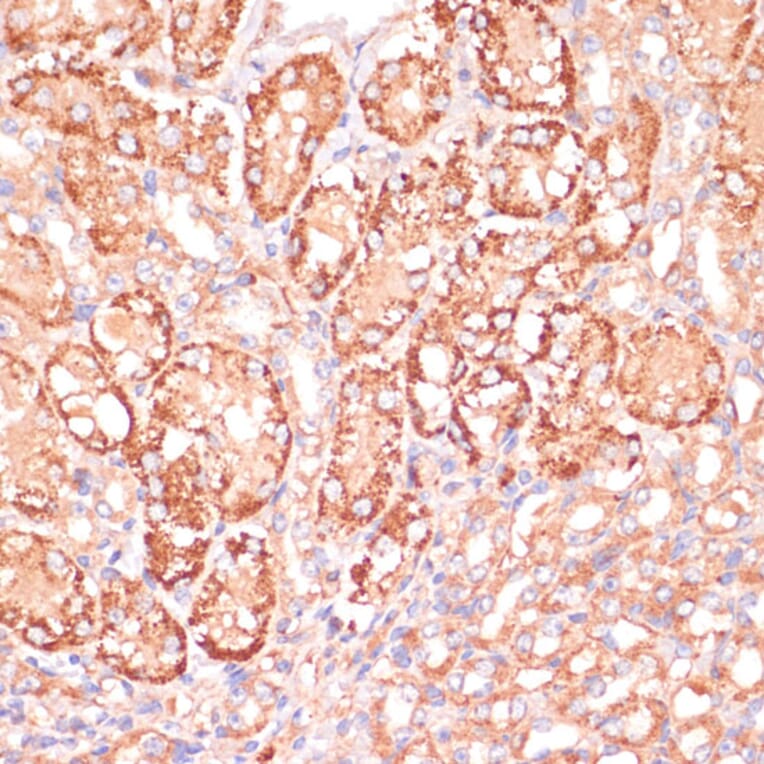 Immunohistochemistry - Anti-MEK3 Antibody (A15852) - Antibodies.com