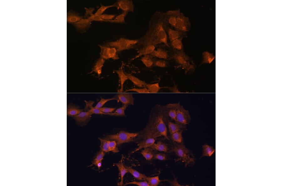 Immunofluorescence - Anti-MEK3 Antibody (A15852) - Antibodies.com