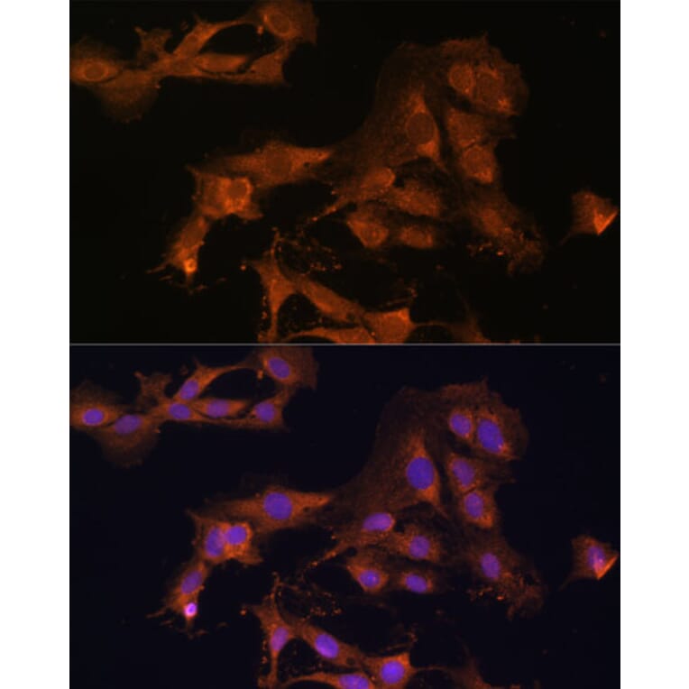 Immunofluorescence - Anti-MEK3 Antibody (A15852) - Antibodies.com