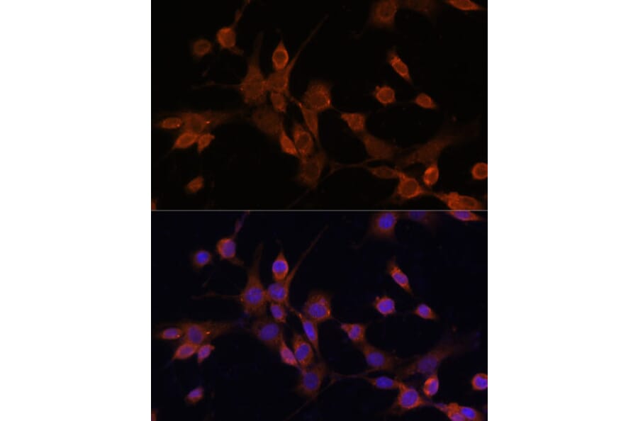 Immunofluorescence - Anti-MEK3 Antibody (A15852) - Antibodies.com