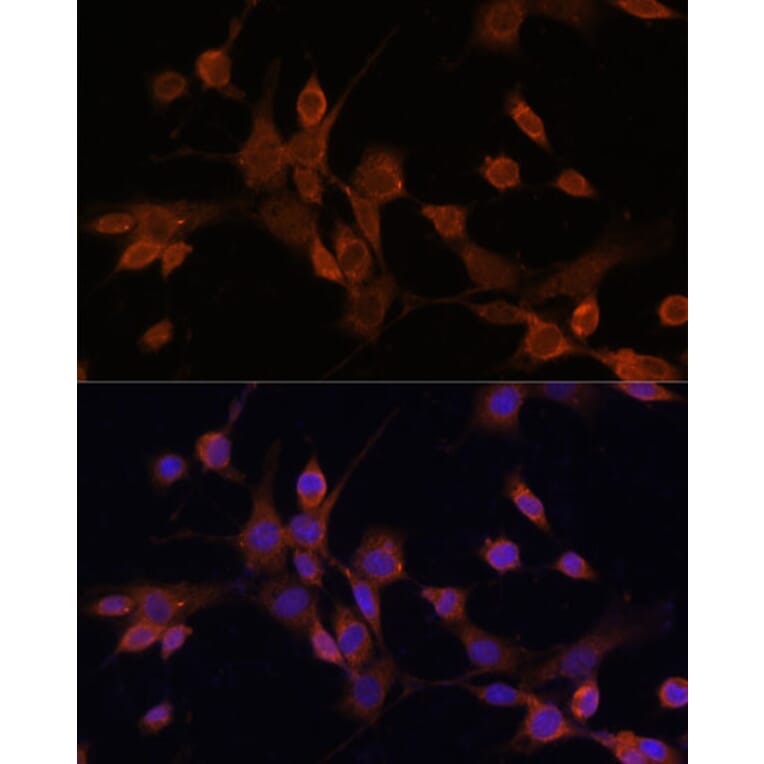 Immunofluorescence - Anti-MEK3 Antibody (A15852) - Antibodies.com