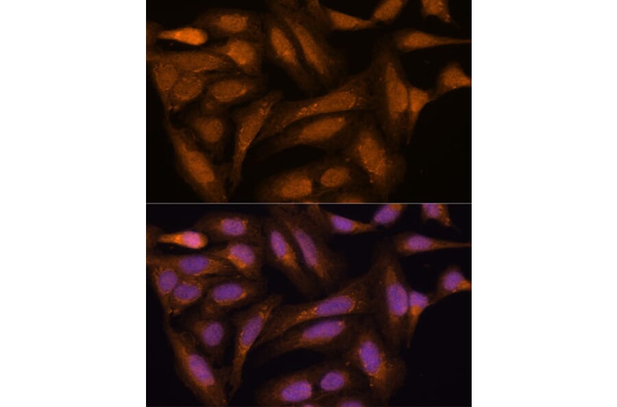 Immunofluorescence - Anti-MEK3 Antibody (A15852) - Antibodies.com