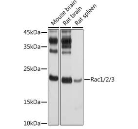 Western Blot - Anti-Rac1 Antibody (A15853) - Antibodies.com