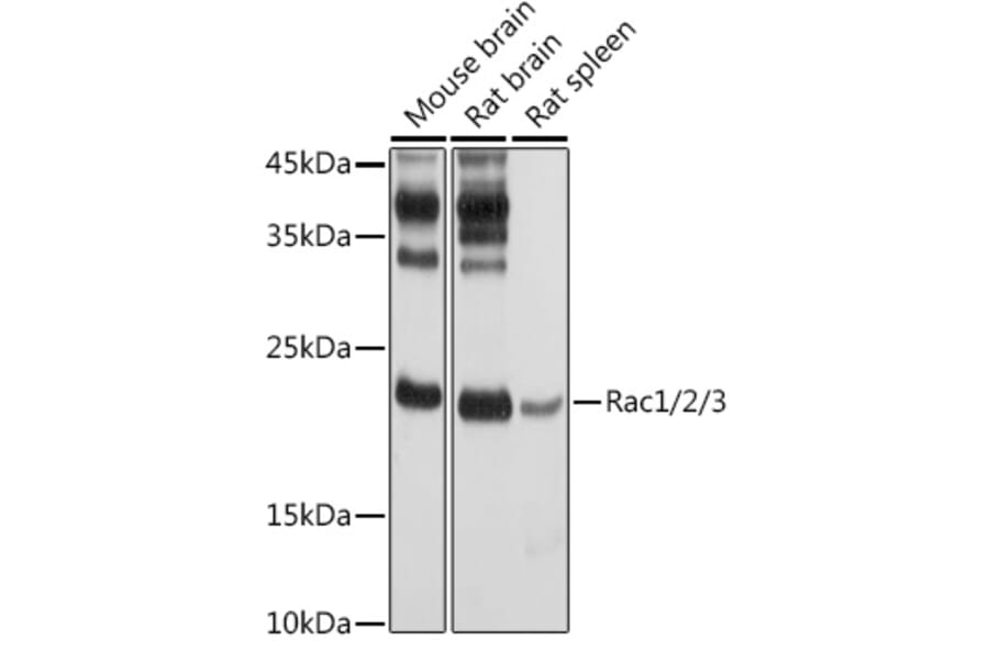 Western Blot - Anti-Rac1 Antibody (A15853) - Antibodies.com