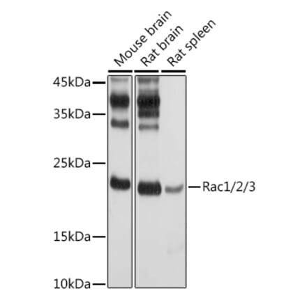 Western Blot - Anti-Rac1 Antibody (A15853) - Antibodies.com