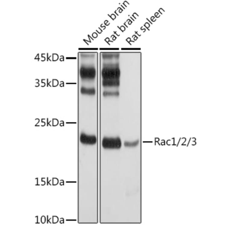 Western Blot - Anti-Rac1 Antibody (A15853) - Antibodies.com