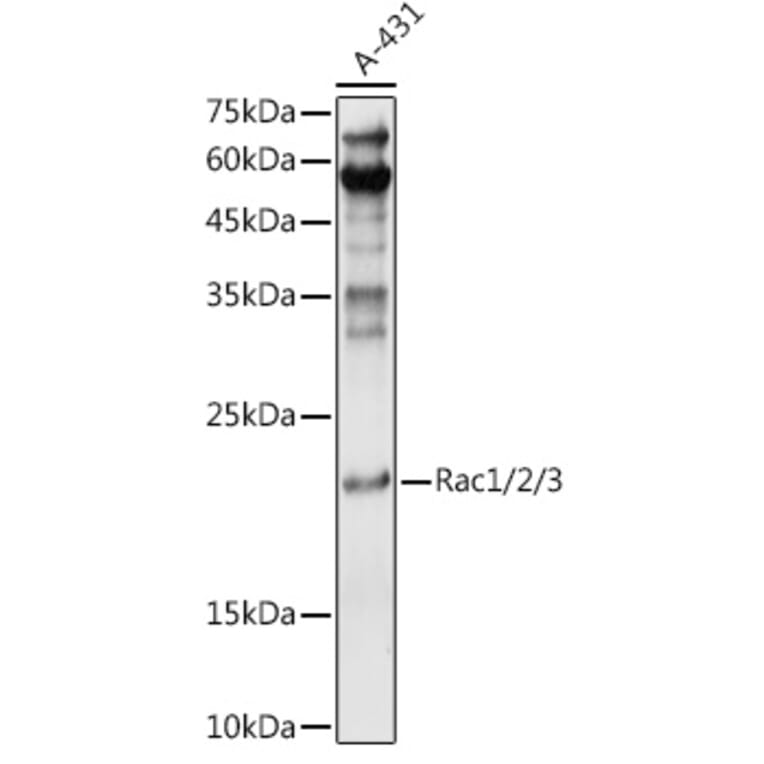 Western Blot - Anti-Rac1 Antibody (A15853) - Antibodies.com