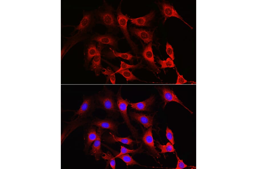 Immunofluorescence - Anti-Rac1 Antibody (A15853) - Antibodies.com