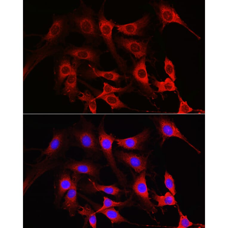 Immunofluorescence - Anti-Rac1 Antibody (A15853) - Antibodies.com