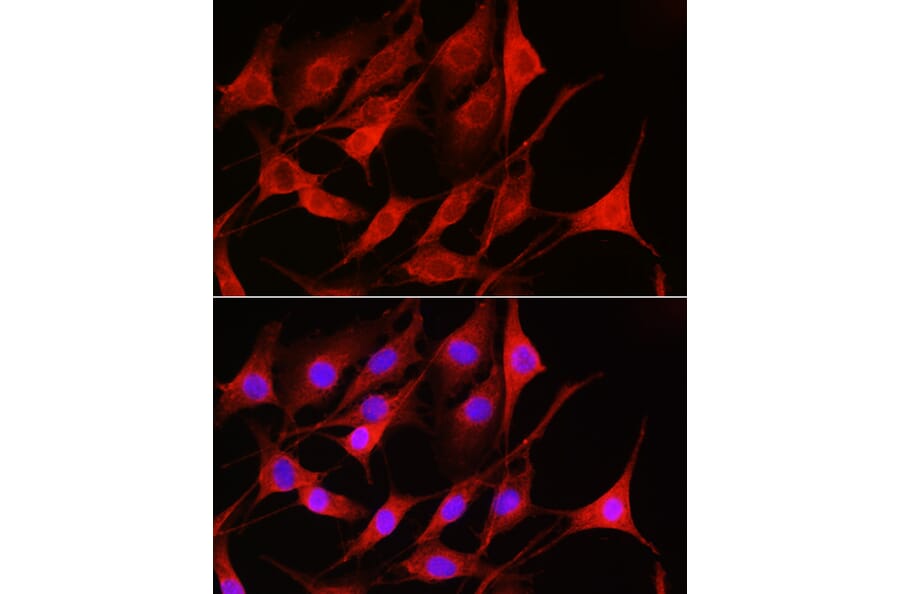 Immunofluorescence - Anti-Rac1 Antibody (A15853) - Antibodies.com