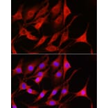 Immunofluorescence - Anti-Rac1 Antibody (A15853) - Antibodies.com