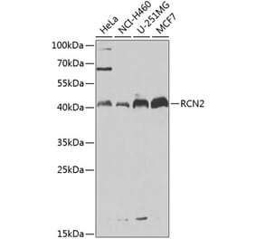 Western Blot - Anti-RCN2 Antibody (A15854) - Antibodies.com