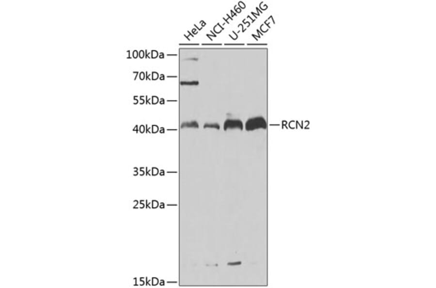 Western Blot - Anti-RCN2 Antibody (A15854) - Antibodies.com