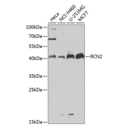 Western Blot - Anti-RCN2 Antibody (A15854) - Antibodies.com