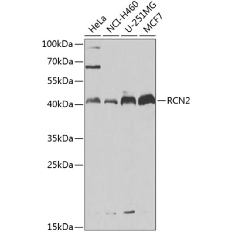 Western Blot - Anti-RCN2 Antibody (A15854) - Antibodies.com