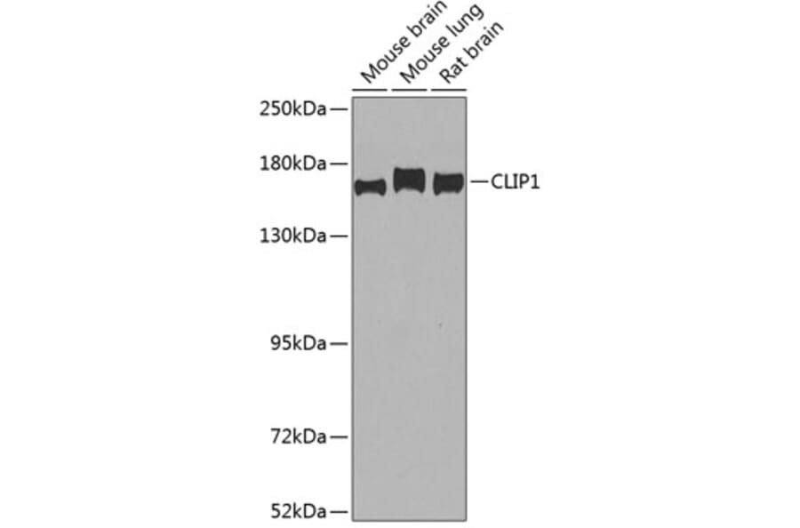 Western Blot - Anti-CLIP170 Antibody (A15855) - Antibodies.com