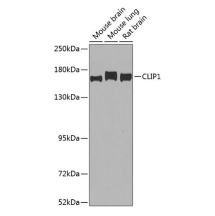 Western Blot - Anti-CLIP170 Antibody (A15855) - Antibodies.com