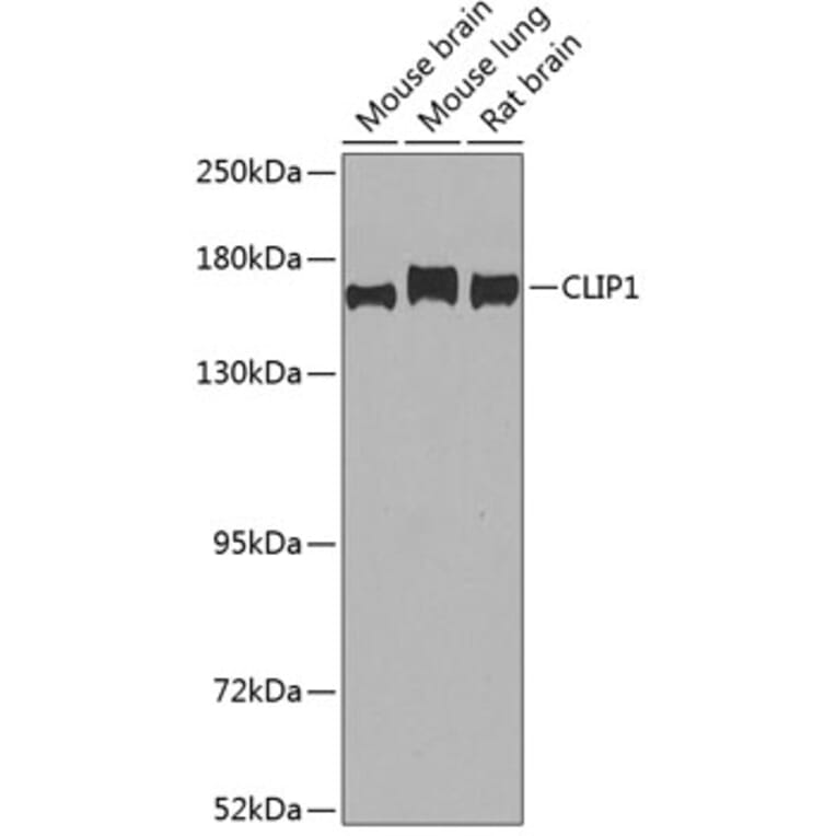 Western Blot - Anti-CLIP170 Antibody (A15855) - Antibodies.com