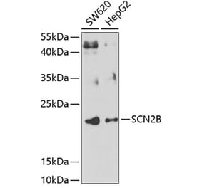 Western Blot - Anti-Scn2b Antibody (A15856) - Antibodies.com