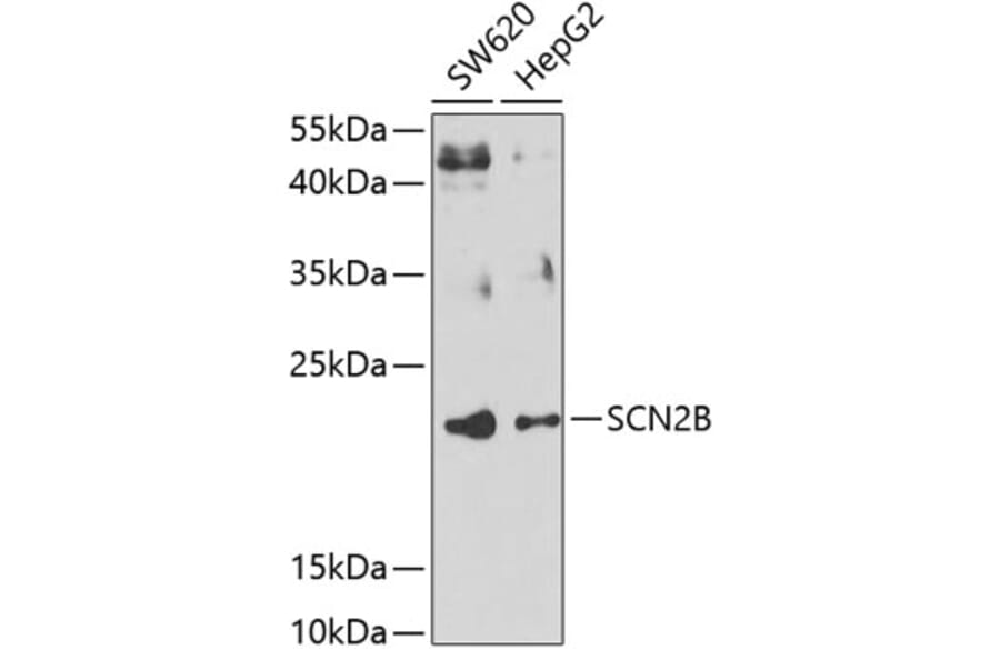 Western Blot - Anti-Scn2b Antibody (A15856) - Antibodies.com