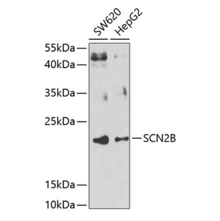 Western Blot - Anti-Scn2b Antibody (A15856) - Antibodies.com