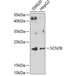 Western Blot - Anti-Scn2b Antibody (A15856) - Antibodies.com