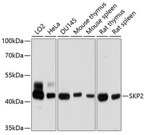 Western Blot - Anti-SKP2 Antibody (A15857) - Antibodies.com