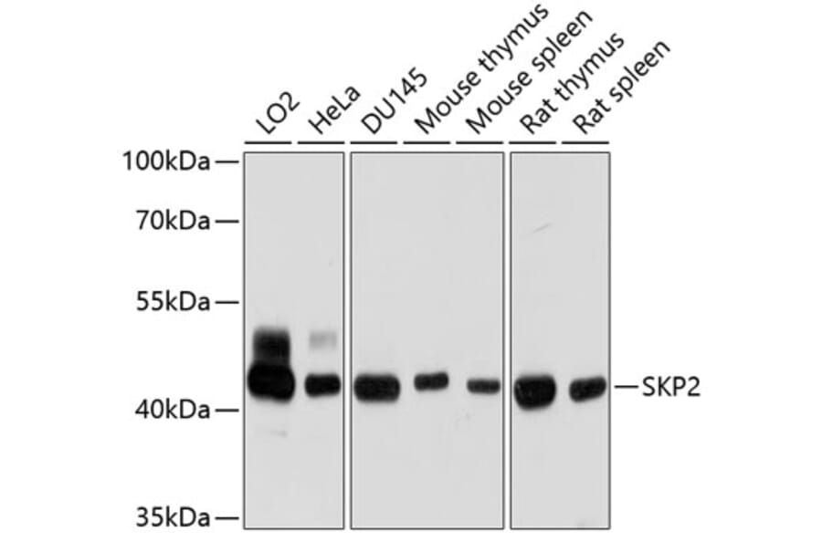 Western Blot - Anti-SKP2 Antibody (A15857) - Antibodies.com