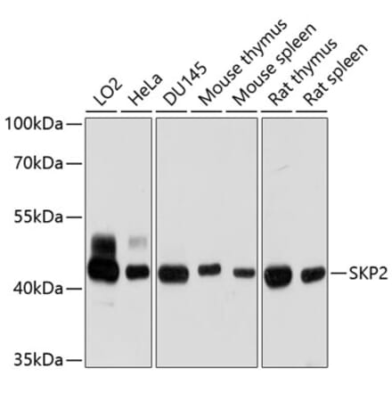 Western Blot - Anti-SKP2 Antibody (A15857) - Antibodies.com
